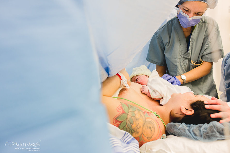 Breastfeeding After A Cesarean Section
