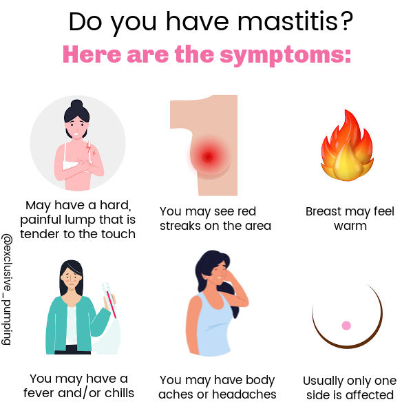 Mastitis: Causes, Symptoms, And Treatment